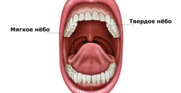 Чешется небо во рту: почему и что делать?