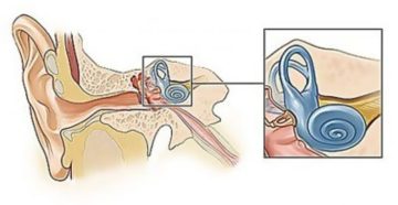Лабиринтит воспаление внутреннего уха: признаки и способы лечения