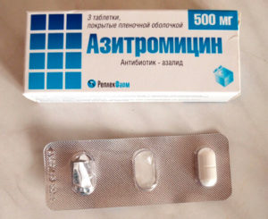 Какие антибиотики в таблетках лучше принимать при ангине?