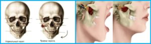 Болит челюсть возле уха основные причины симптома