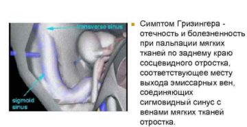 Отогенный сепсис: признаки, диагностика и особенности лечения