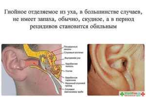 Как распознать гнойный отит у детей и вылечить заболевание?