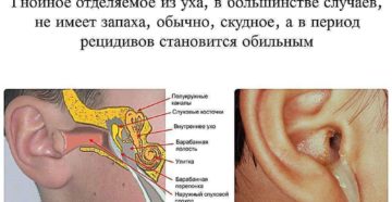 Как распознать гнойный отит у детей и вылечить заболевание?