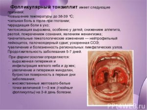 Причины возникновения боли в горле при глотании и методика лечения