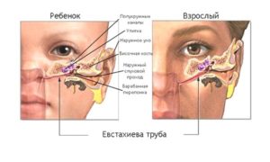 Как убрать сопли из носоглотки у ребенка: основные способы