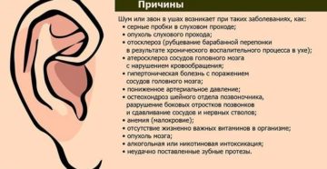 Почему возникает шум в ушах и что делать?