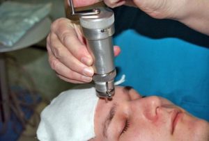 Трепанопункция лобной пазухи эффективный хирургический метод лечения фронтита