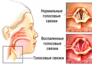 спазм в горле причины